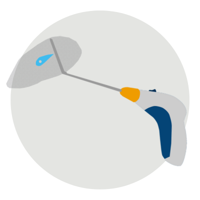 Reparación de hernia